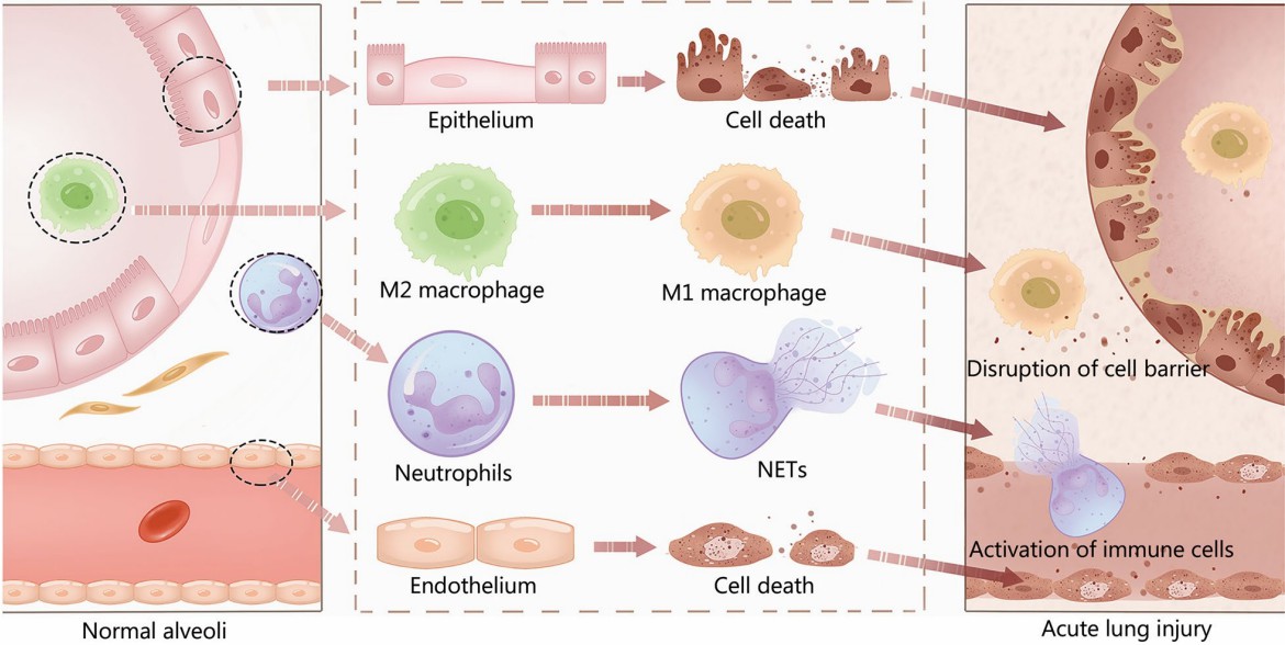 Fig.2 Alveolar cells involved in lung Injury.